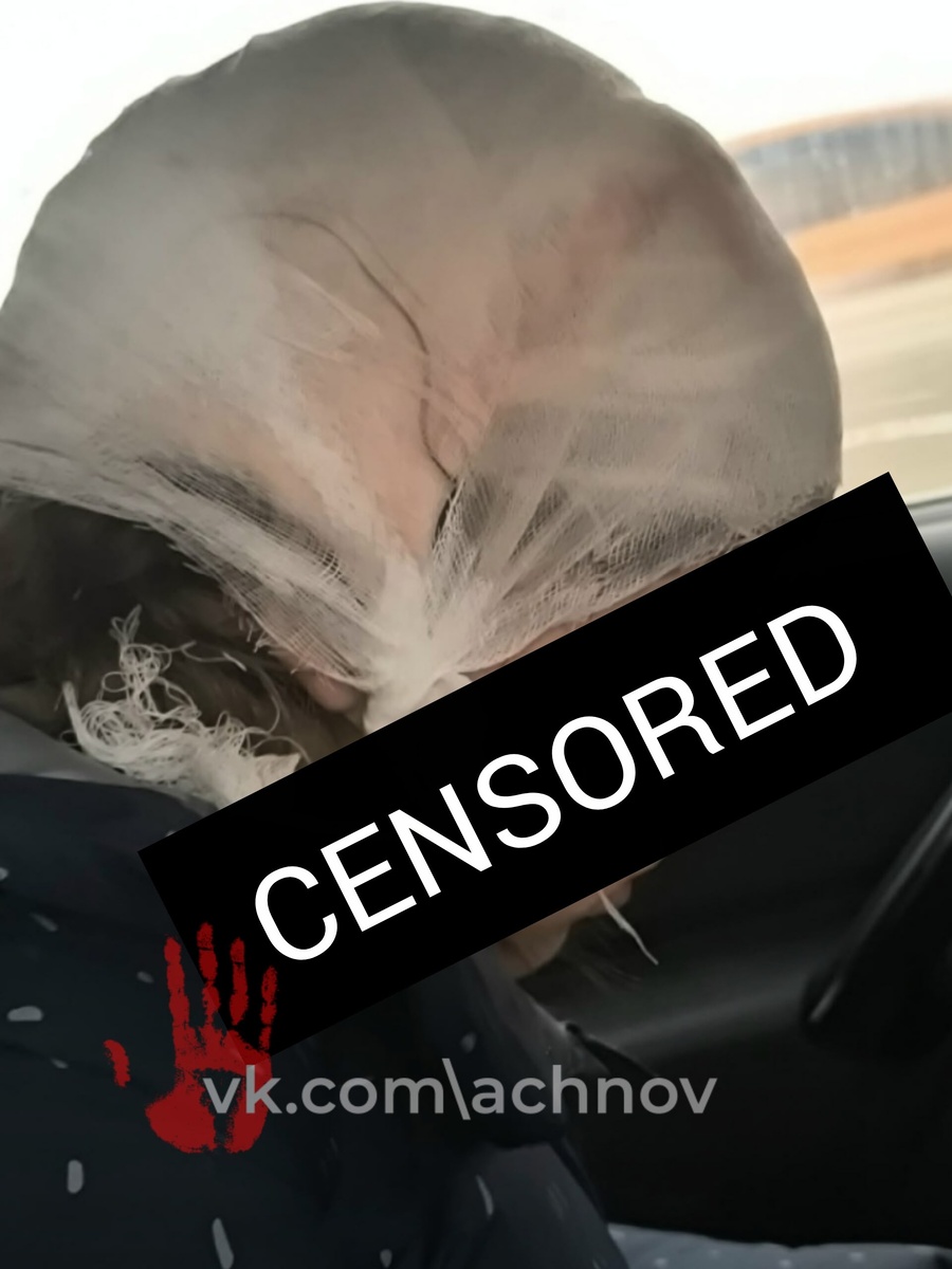 Девочке оказали первую помощь