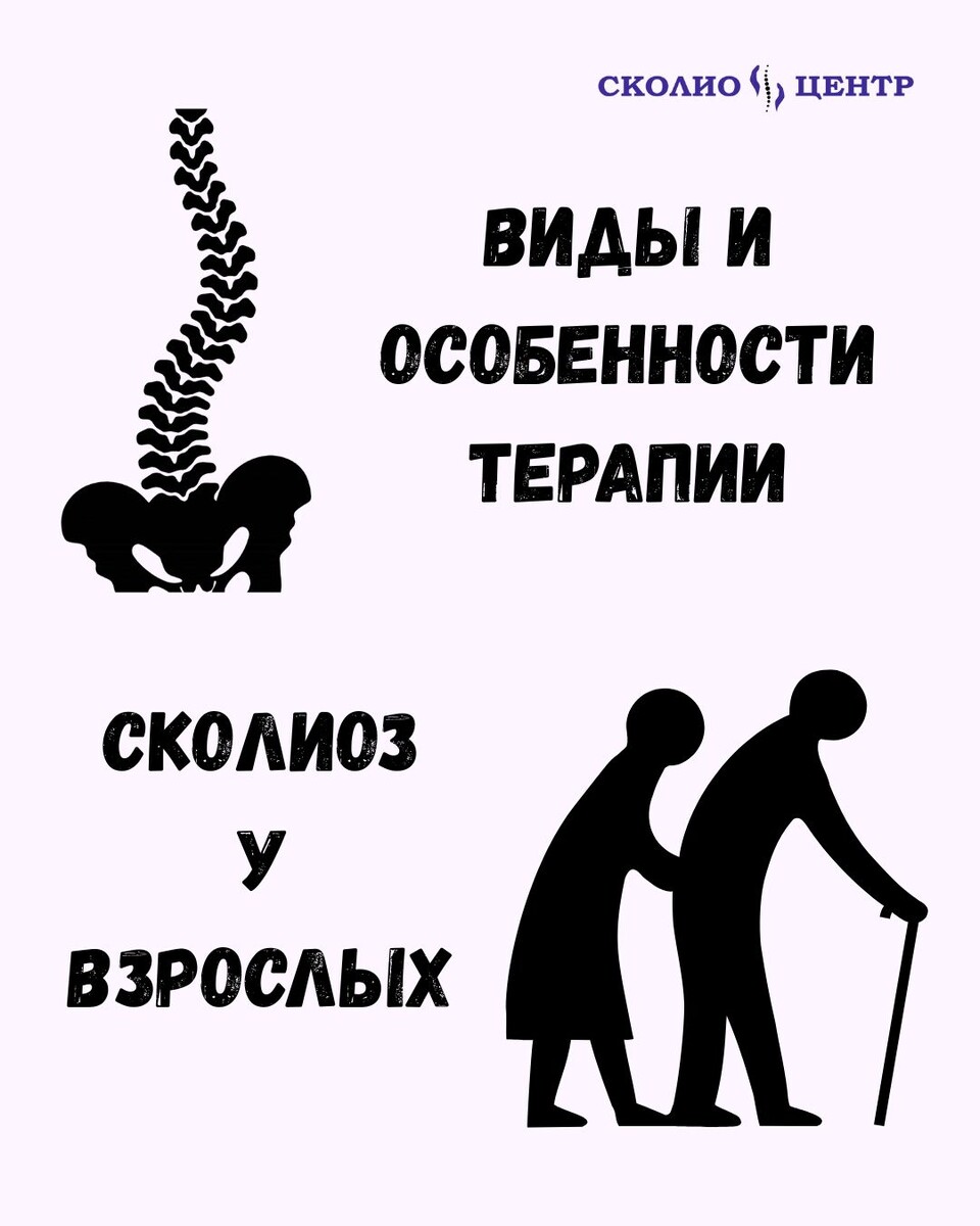 Сколиоз у взрослых. Виды и особенности терапии