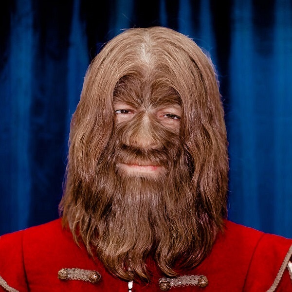 Больной гипертрихозом. Фото Elen Tkacheva/Shutterstock/FOTODOM