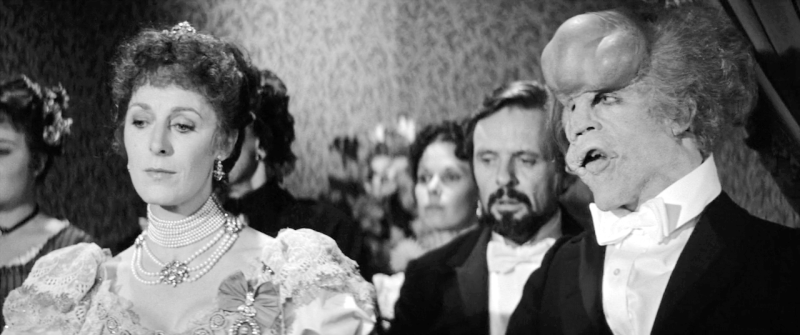 Кадр из фильма Дэвида Линча «Человек-слон» (1980)