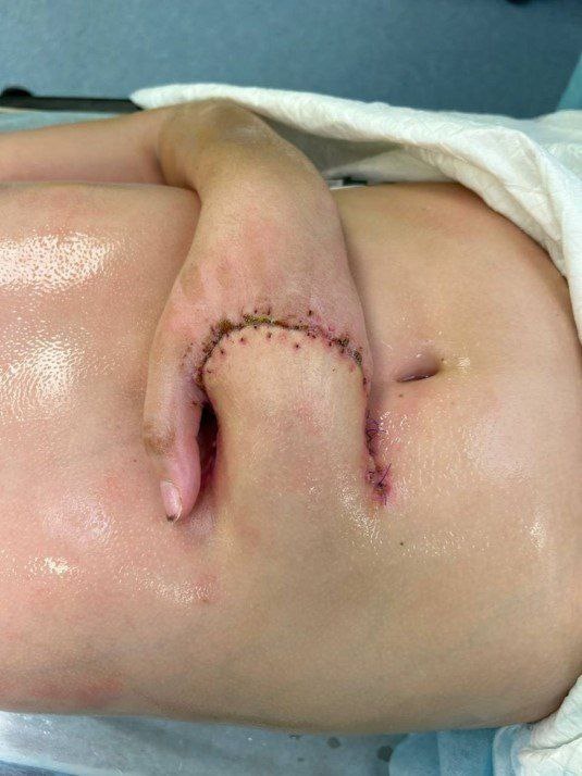    Фото: скрин видео с канала "ММКЦ "Коммунарка", источник: t.me/mmcckommunarka