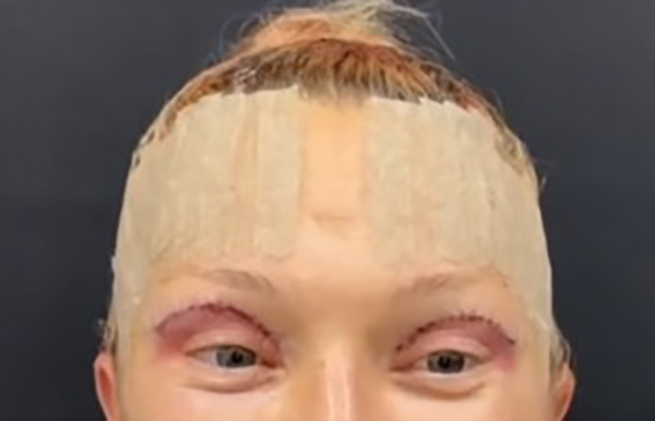 Кадр из видео хирурга, который активно ратует за пластыри. 