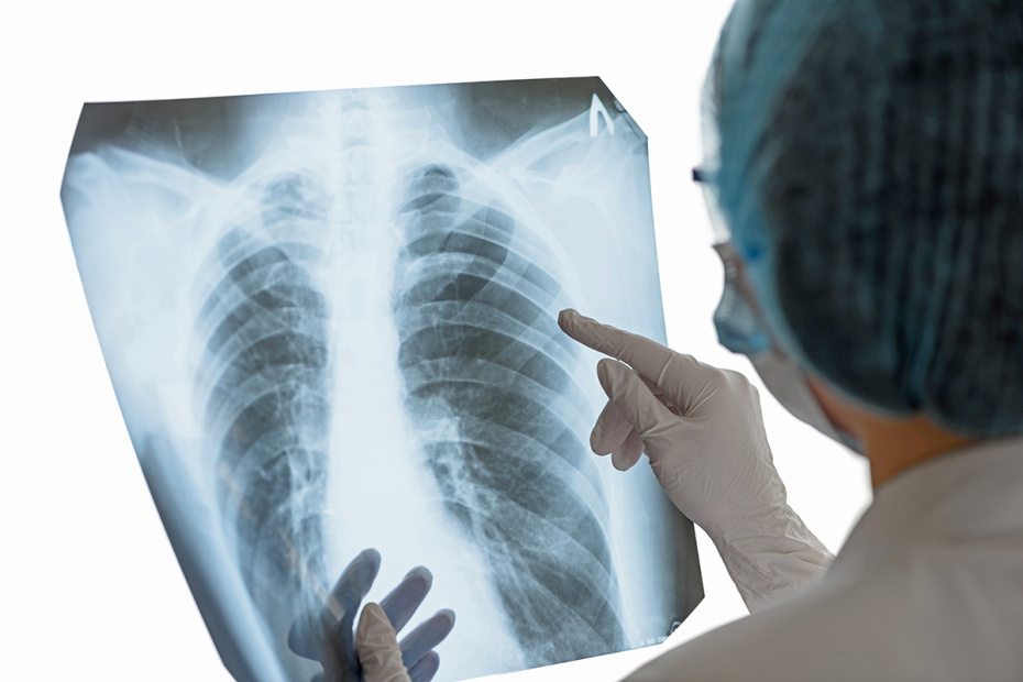    Shutterstock/FOTODOM