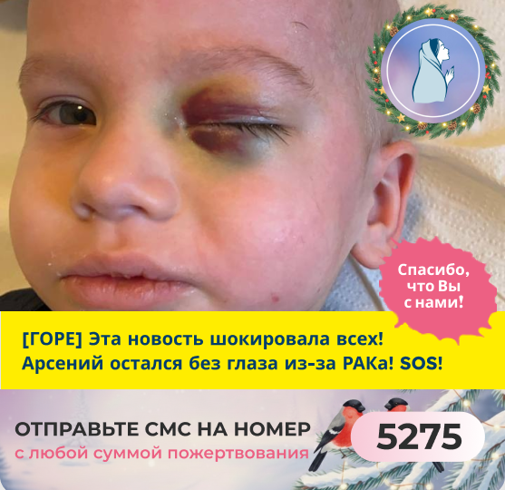 Случилось самое страшное... Малыш остался без глаза! Спасите Арсению жизнь!