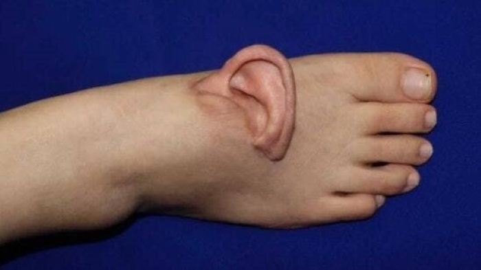 То самое ухо. Фото с сайта https://www.odditycentral.com/