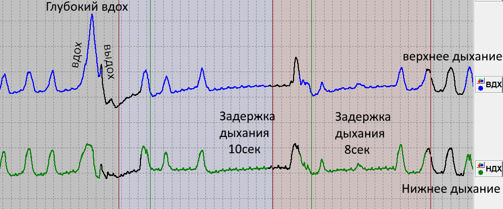 Пример полиграмм по какналам дыхания. Синий - верхнее. Зеленый - нижнее. Вертикальные пунктирные полосы - время. Между двумя полосами - 1 секунда.