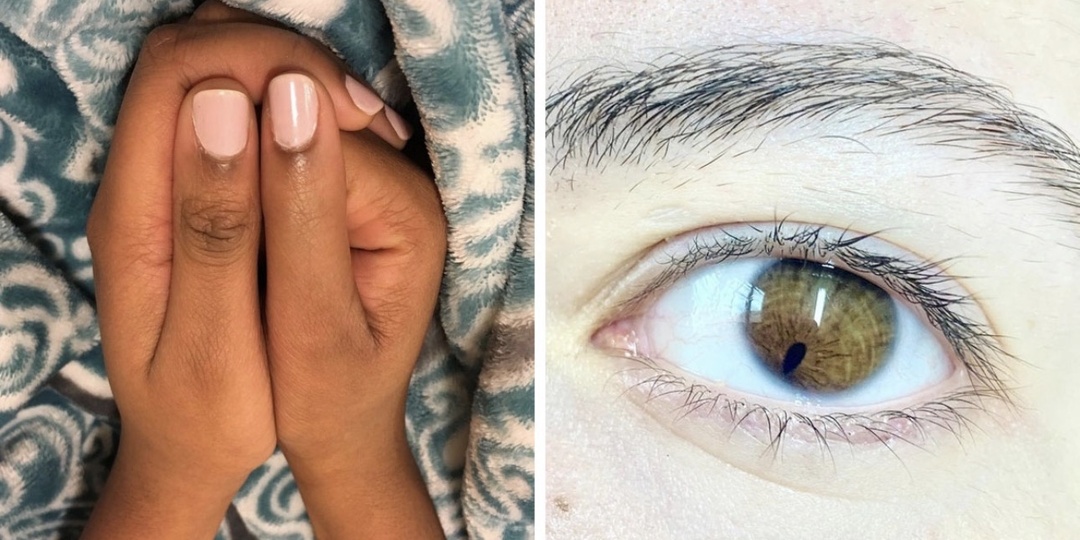 20 человек с необычной внешностью, которые полюбили себя и открыли свое лицо миру