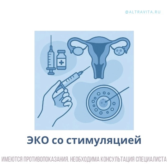 ЭКО со стимуляцией