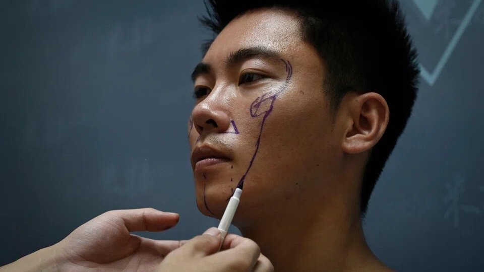 История и тренды пластической хирургии в Южной Корее