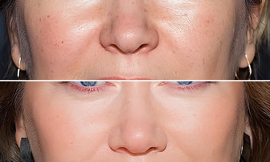 Возрастная особенность, на которую не обращают внимания женщины 50+: маскируем для свежего вида