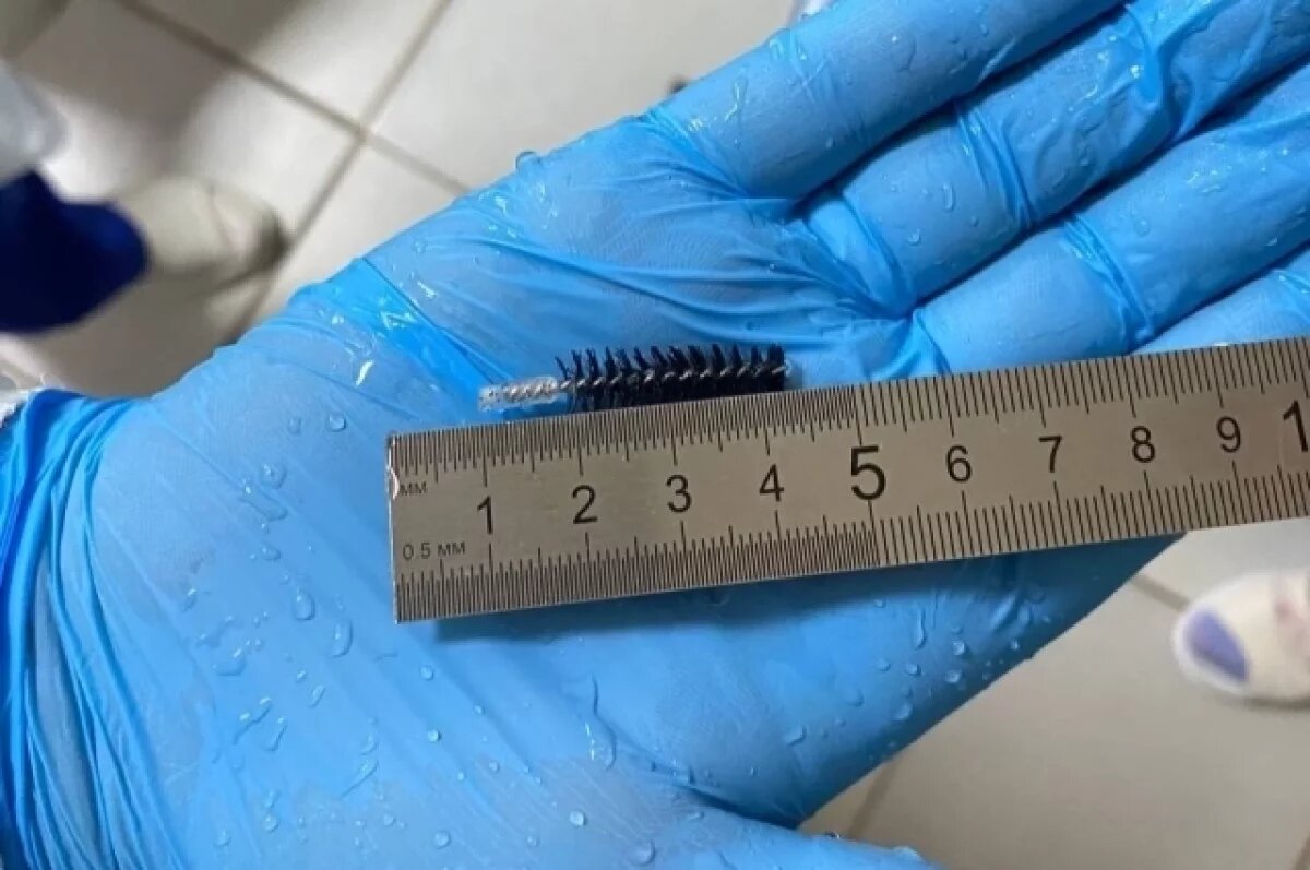    Врач удалил обломок ершика из бронхов пациента из Владимира