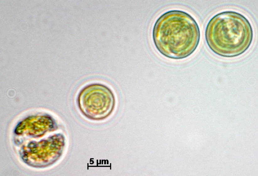Световая микрофотография водоросли Vischeria punctata. Источник: ИФР РАН