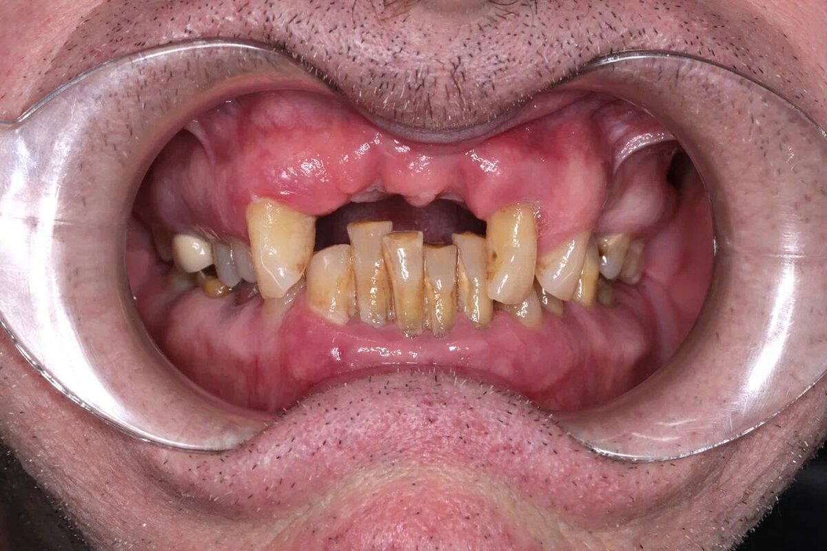 Сергей Анатольевич, г. Москва, клиника доктора Севака Estetus