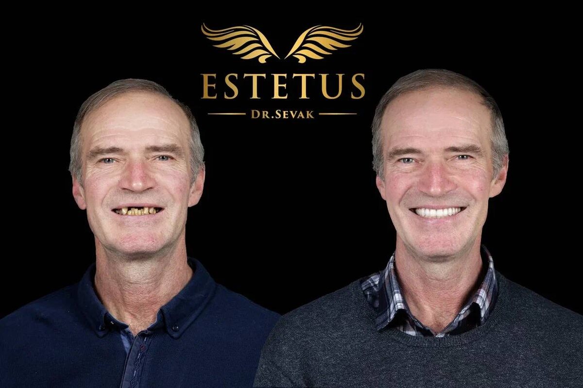 Сергей Анатольевич, г. Москва, клиника доктора Севака Estetus