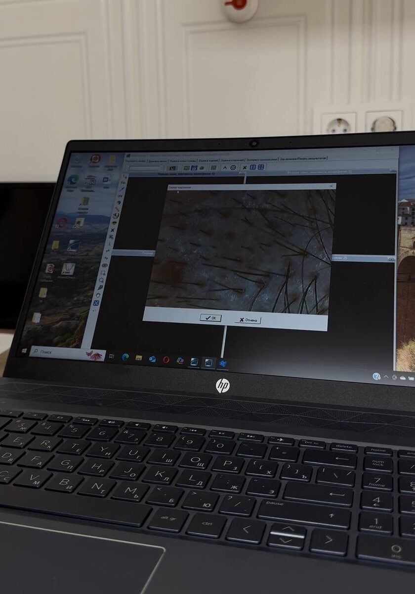 Что видит врач на экране