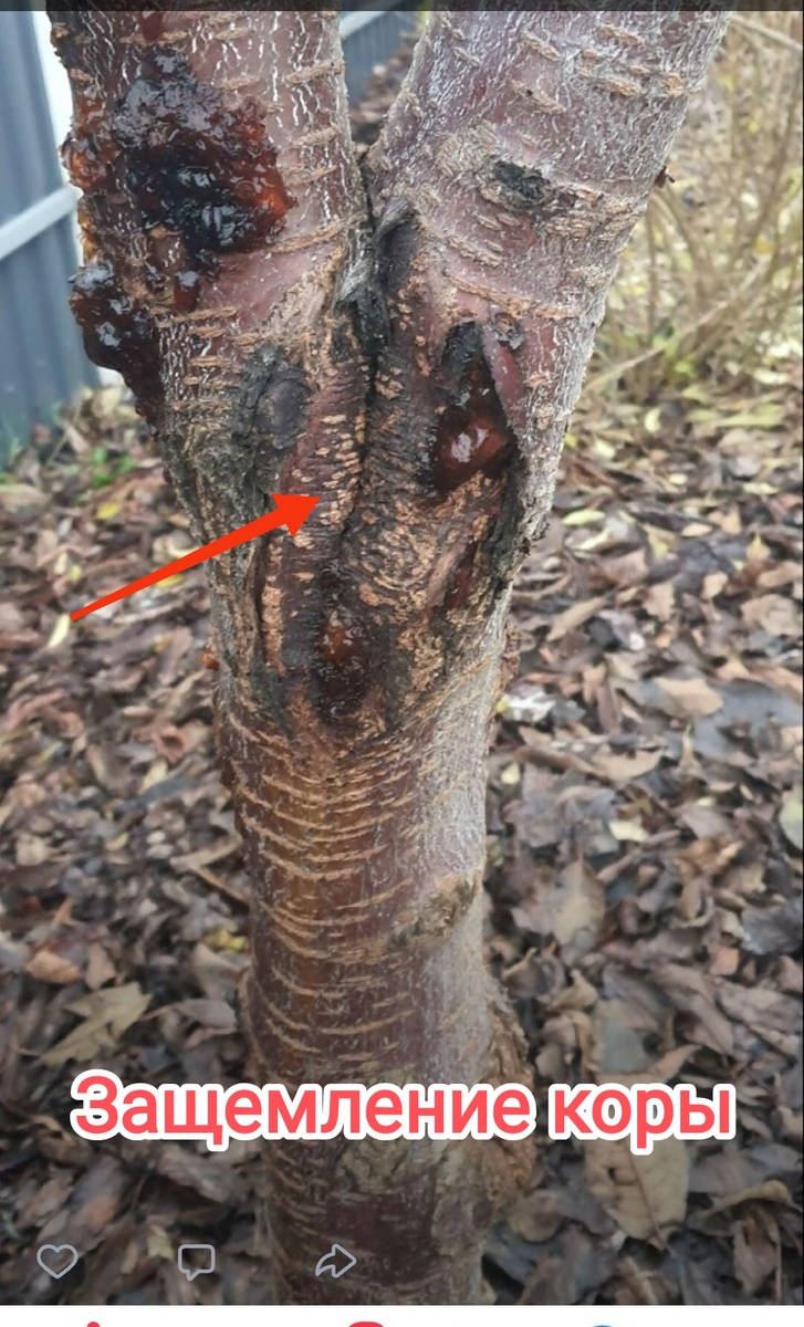 Защемление коры. 