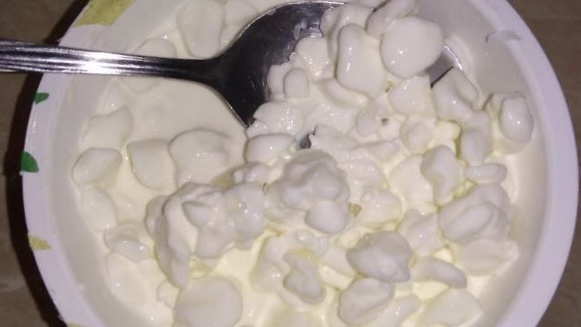 Желчный пузырь перегружен, несмотря на диету. 7 привычек в рационе, провоцирующие застой желчи