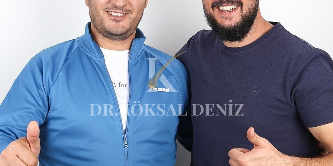 Пересадка волос по турецким стандартам теперь в г. Казани