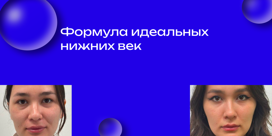 Формула идеальных нижних век