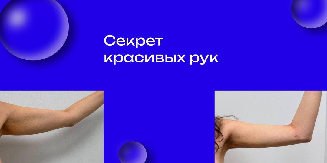 Когда руки выдают возраст