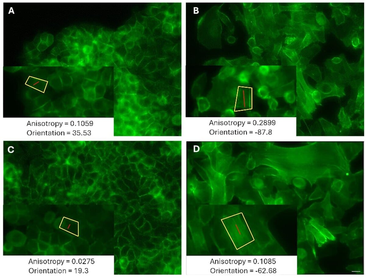    Типичное изображение актиновых волокон, окрашенных фаллоидином, клеток LM (A , C) MCF7 и HM (B , D) MDA-MB-231 во время появления. (A , B) Лидерные клетки. (C , D) Периферические клетки / © Advancing Nanotechnology in Cancer Theranostics