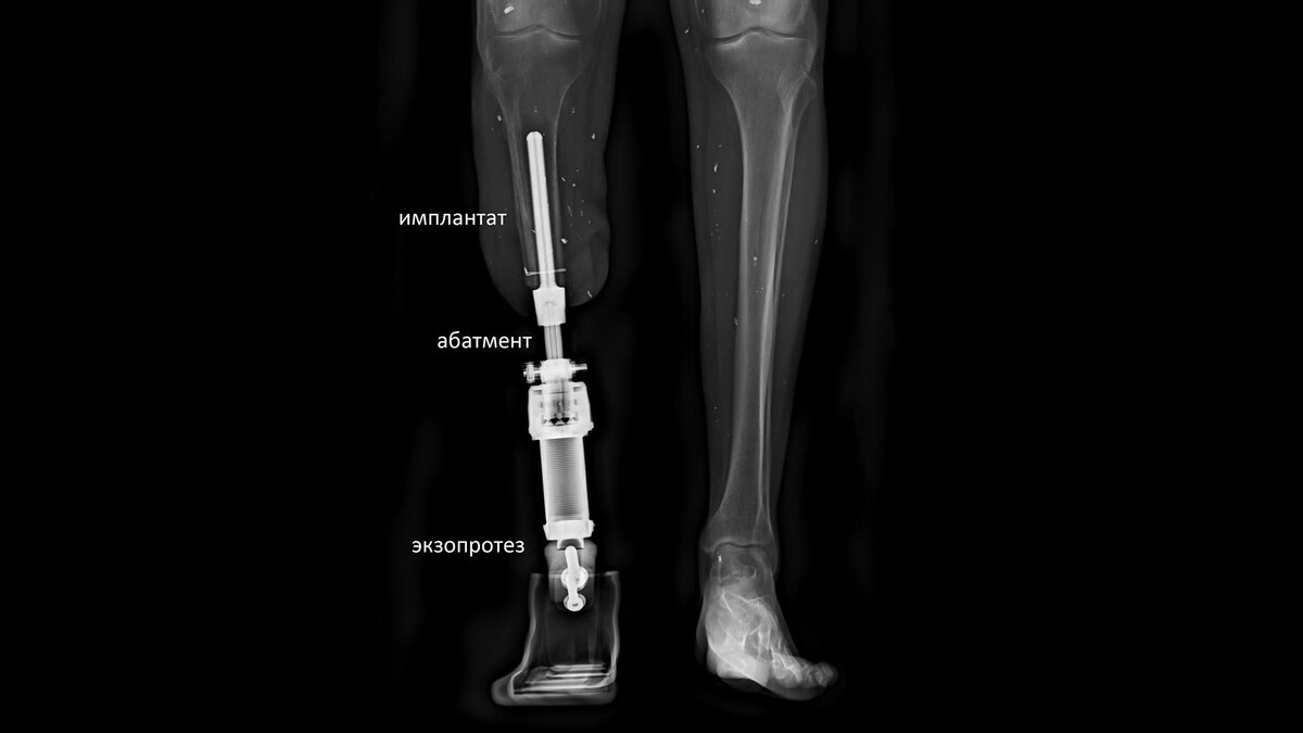    Фото: НМИЦ травматологии и ортопедии им. Р. Р. Вредена Минздрава России