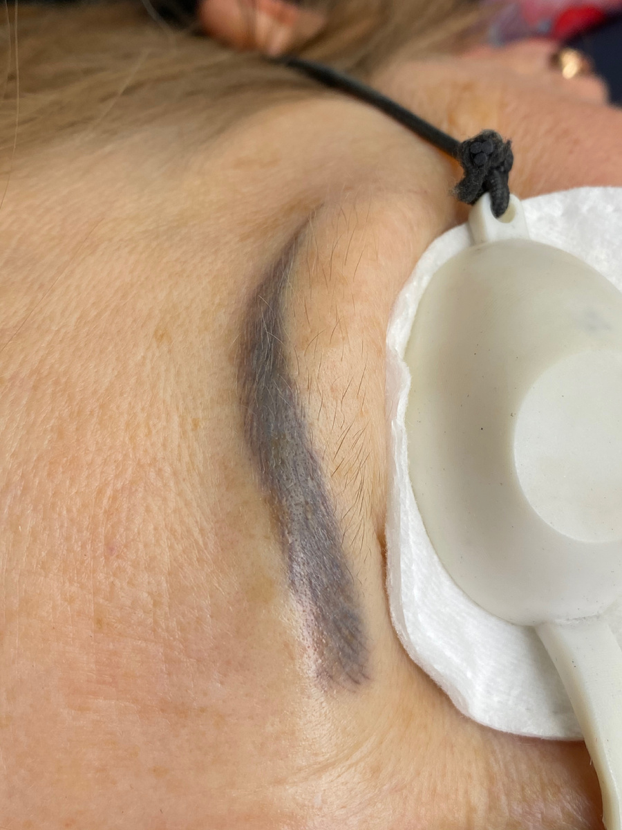 Неудачный татуаж, после неудачного перекрытия😭