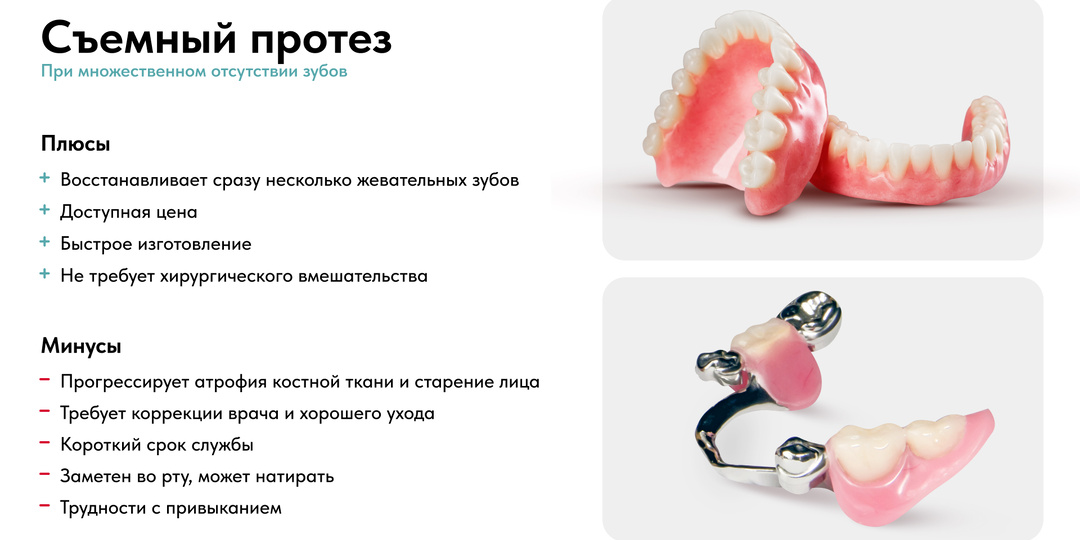 Все способы восстановления зубов в 2026 г.