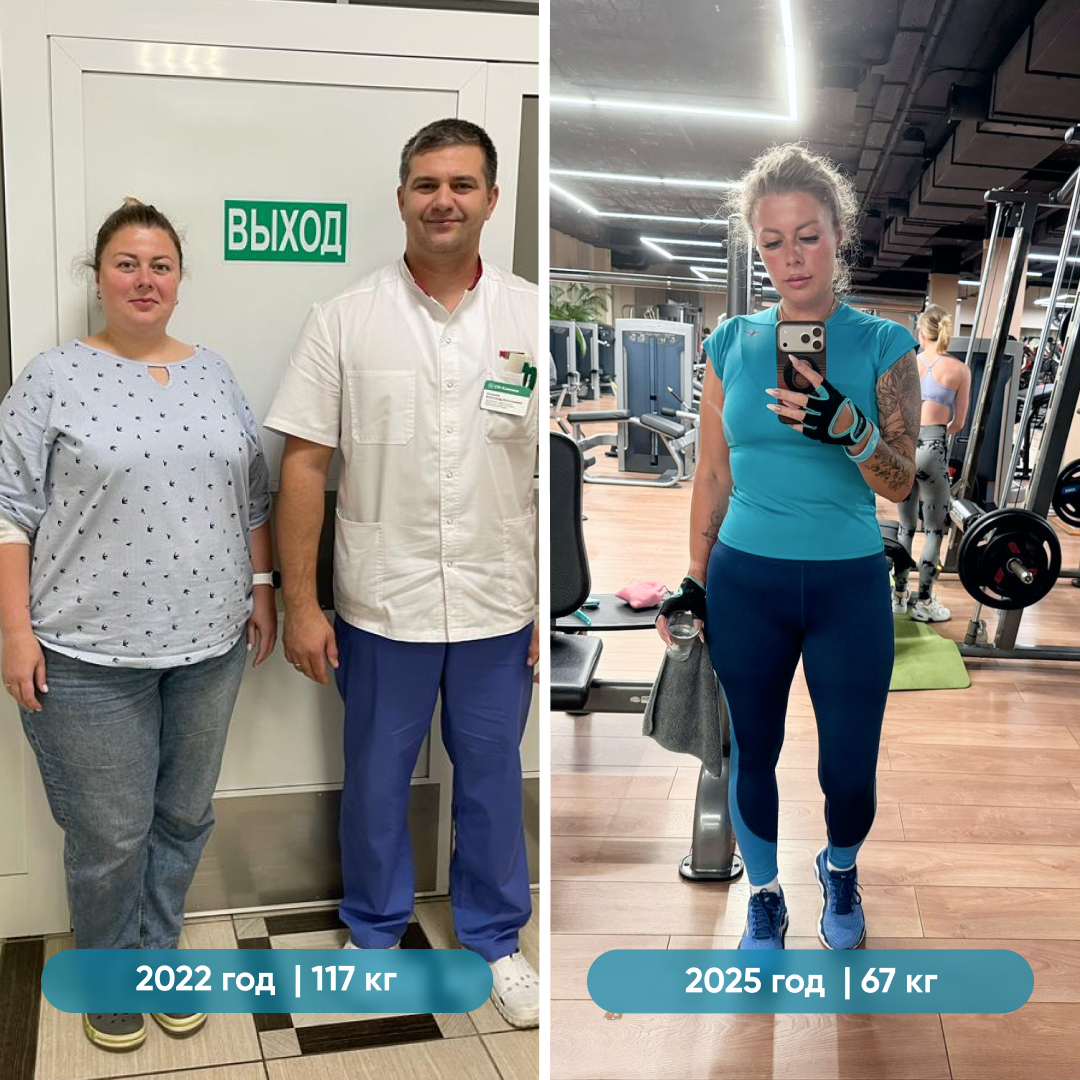 Анна похудела на 50 кг