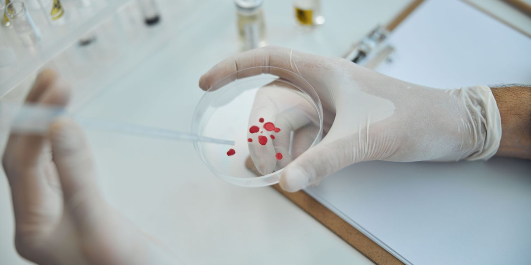 Какие продукты следует мыть, чтобы прогнать паразитов?