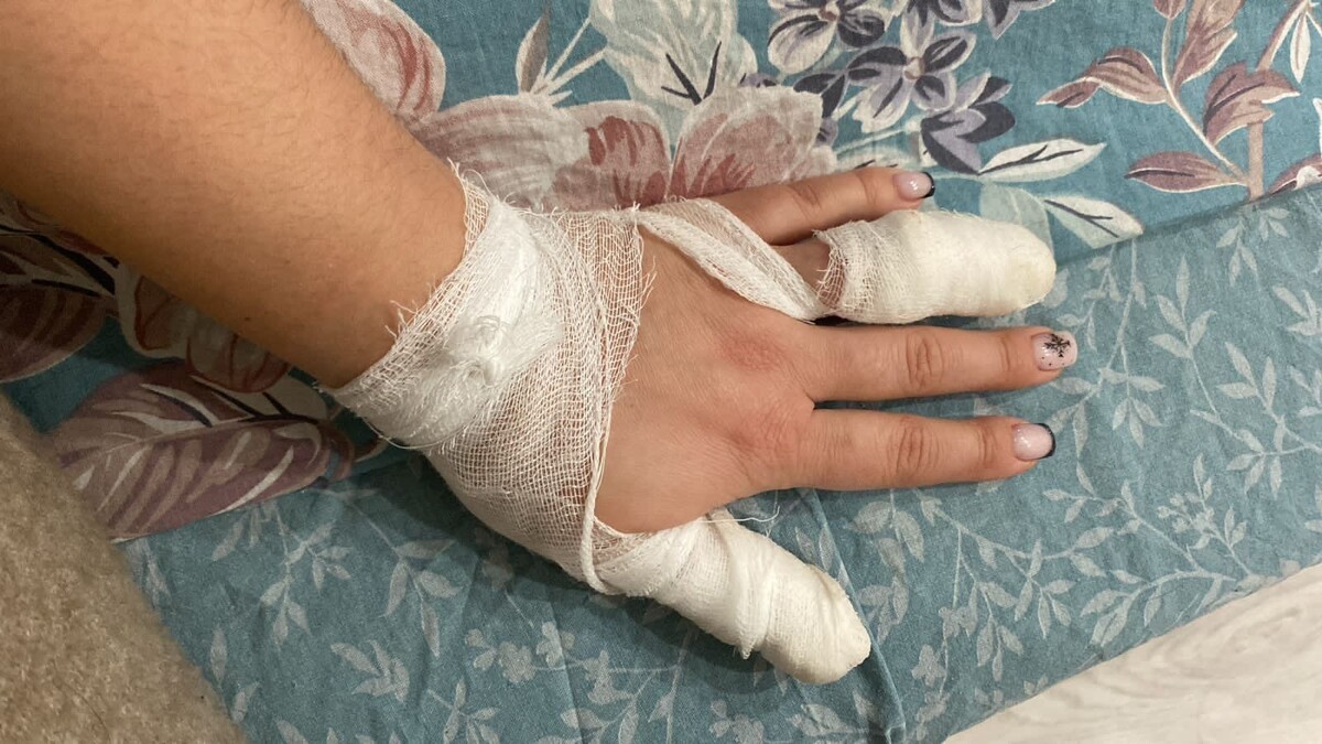    Бультерьер без поводка покусал девушку и ее собаку в Питкяранте© коллаж Столица на Онего / Подслушано в Питкяранте