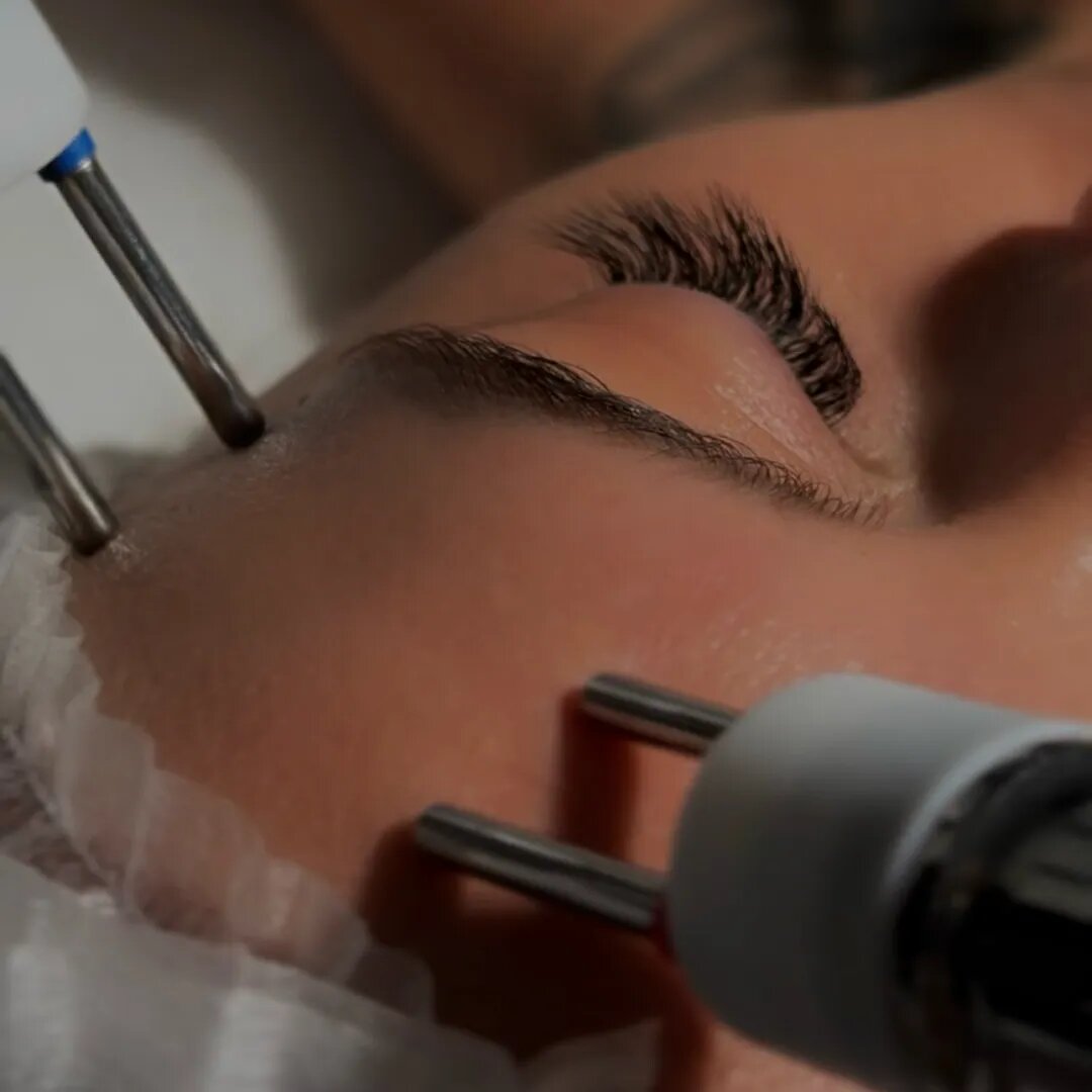 Микротоковая терапия в клинике косметологии Uniqderm