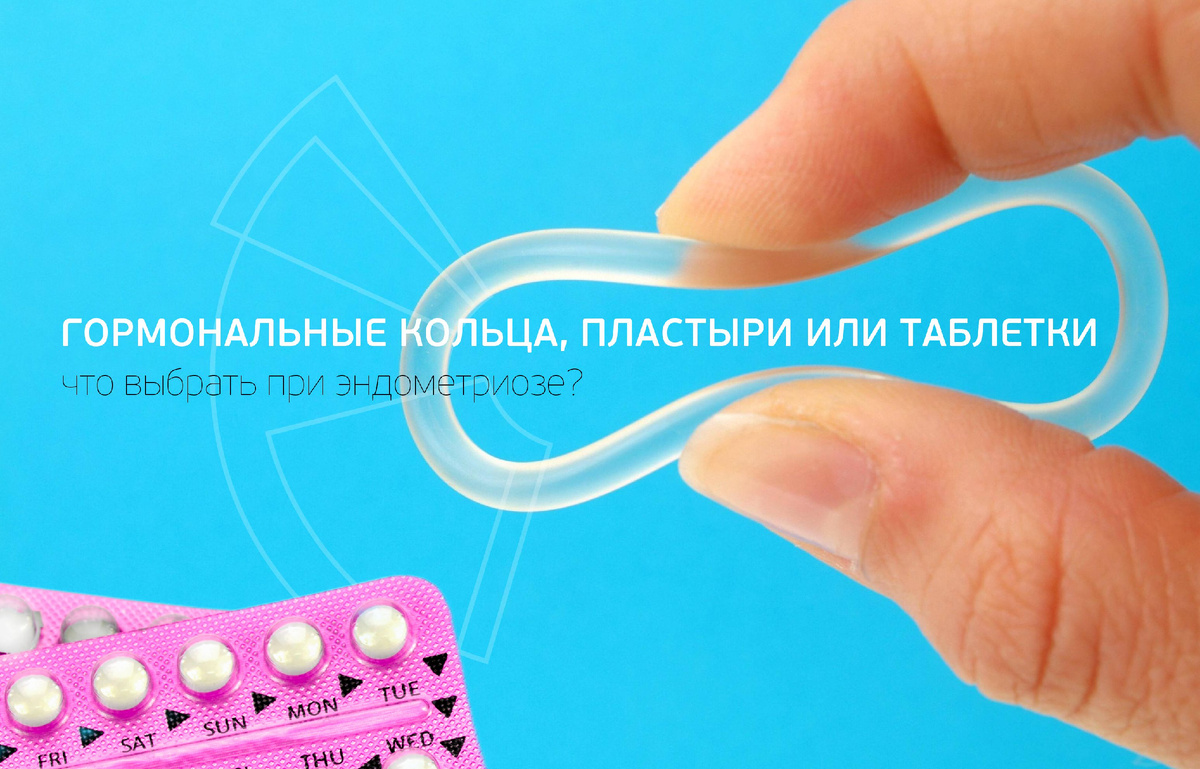 Гормональные кольца, пластыри или таблетки: что выбрать при эндометриозе?