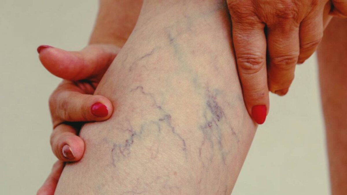 Сосуды не болят