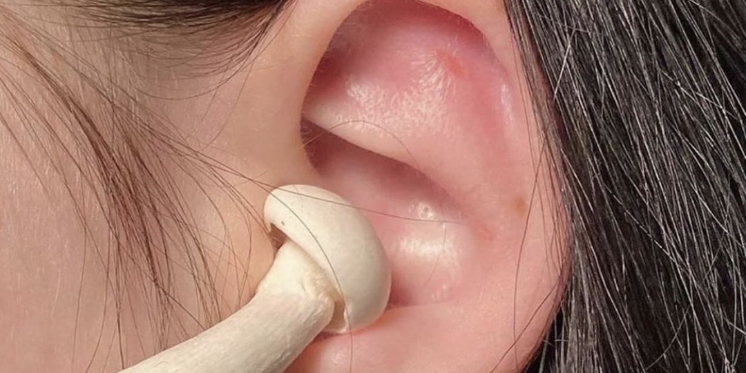 Пошли по грибы: что мы собрали в ухе пациента