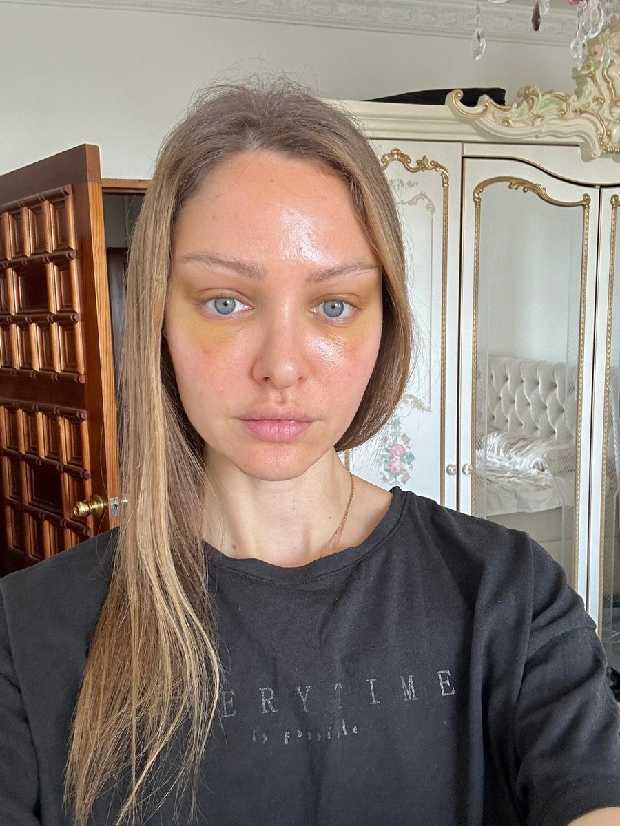 Ранний результат после операции