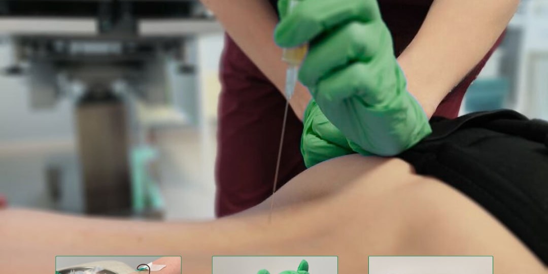 Аутоплазмотерапия