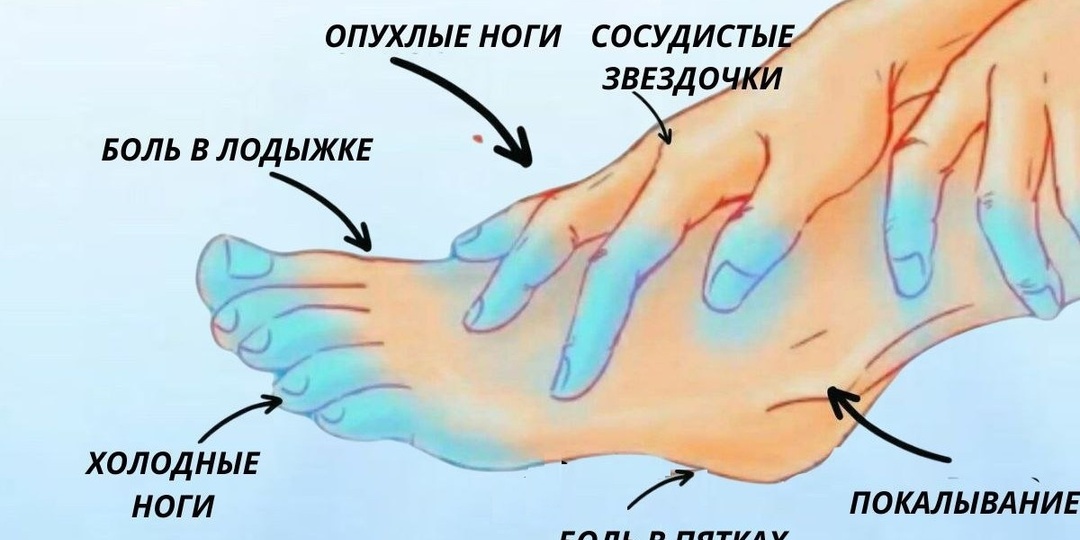 Немеют стопы, появляются мурашки, ранки на стопах не заживают и появляется боль при ходьбе. Вот что организм пытается сказать