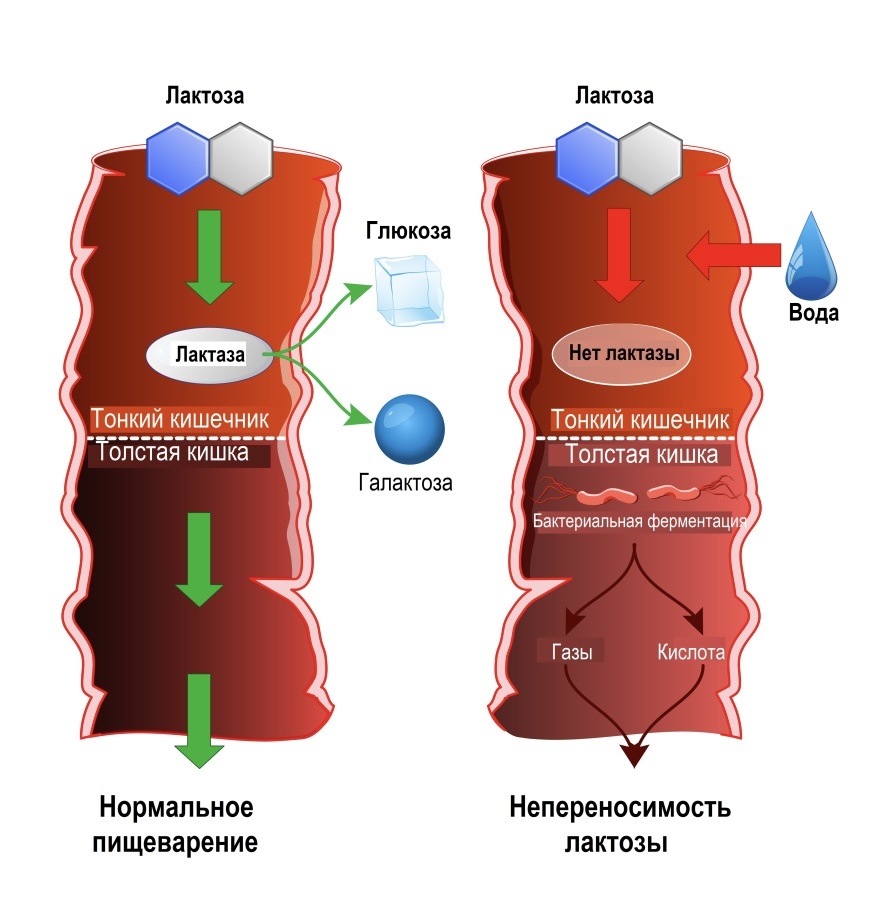 Судьба лактозы в кишечнике: норма и непереносимость.