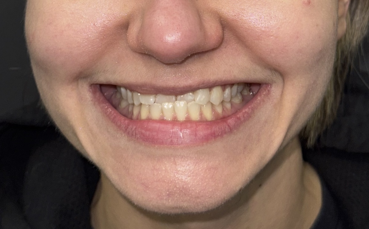 Фото "до", диагностика