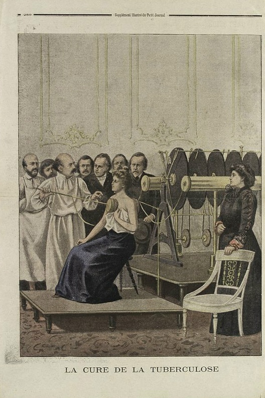 Лечение тyберкyлеза с использованием электричества, производимого динамо-машиной. 1901 год. Картинка: Le Petit Journal (Paris, 1 September 1901). Источник: https://www.sciencephoto.com