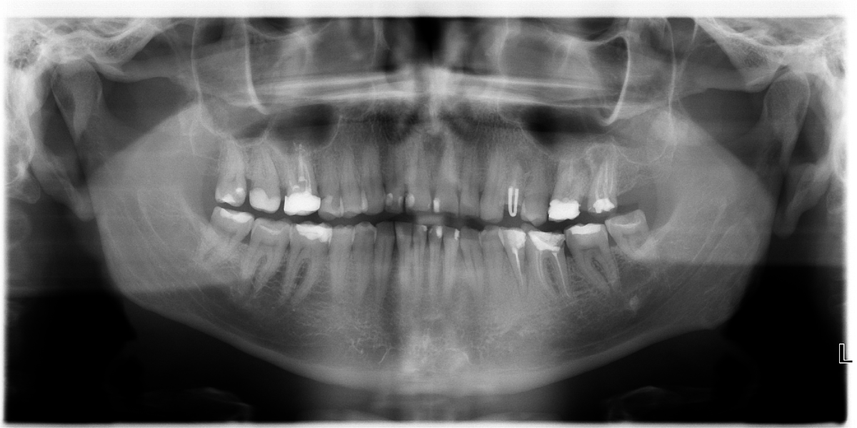 Панорамный снимок