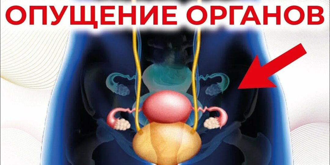«Опущение органов: не «женская напасть», а сигнал организма — что делать, если «всё опускается»