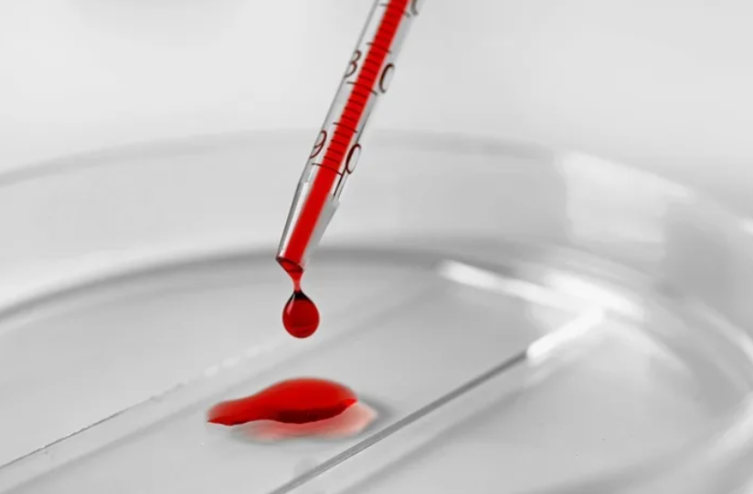 ПРОБА БЮРКЕРА