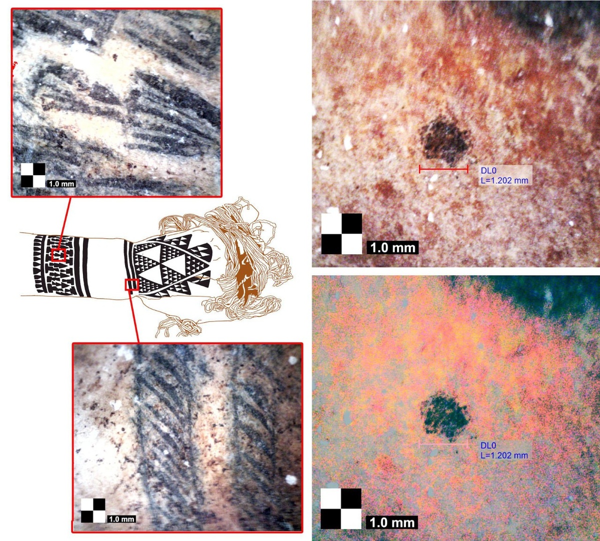 Справа – татуировки сделанные методом надрезов. Справа – единичный тату-прокол под микроскопом.  📷
