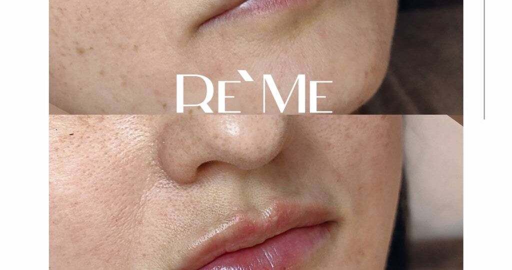 Холод и ветер не щадят губы: они реагируют на смену погоды сухостью, стянутостью и болезненными трещинками