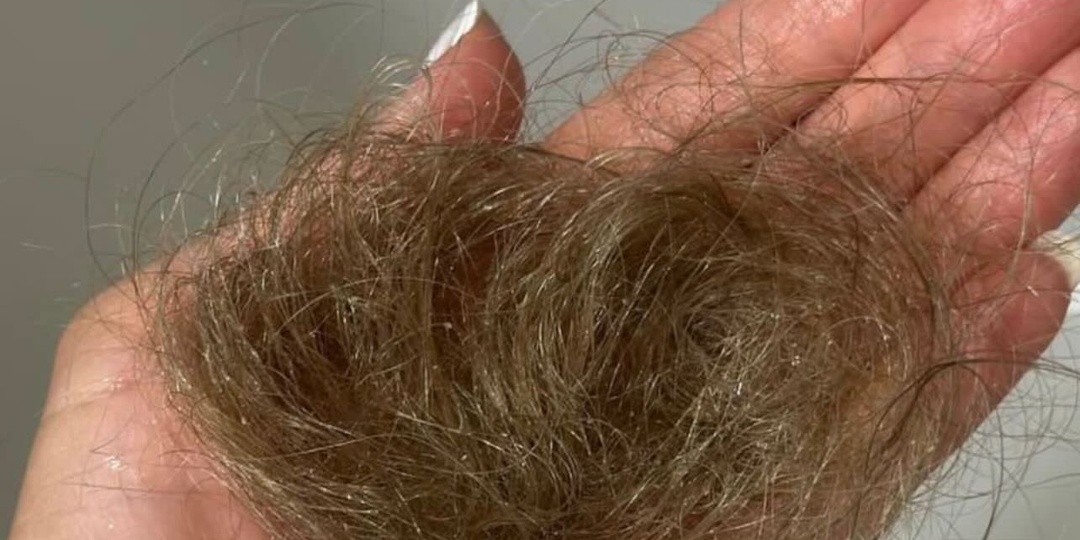 Пища без пользы: 7 тревожных сигналов, что кишечник не усваивает питательные вещества