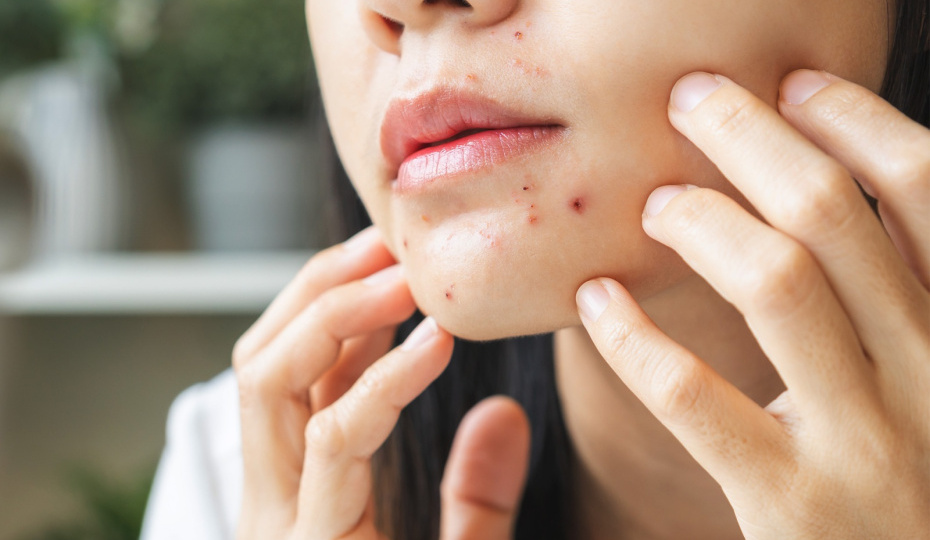 Менингит и некроз мозговой ткани: какая привычка грозит смертельными последствиями