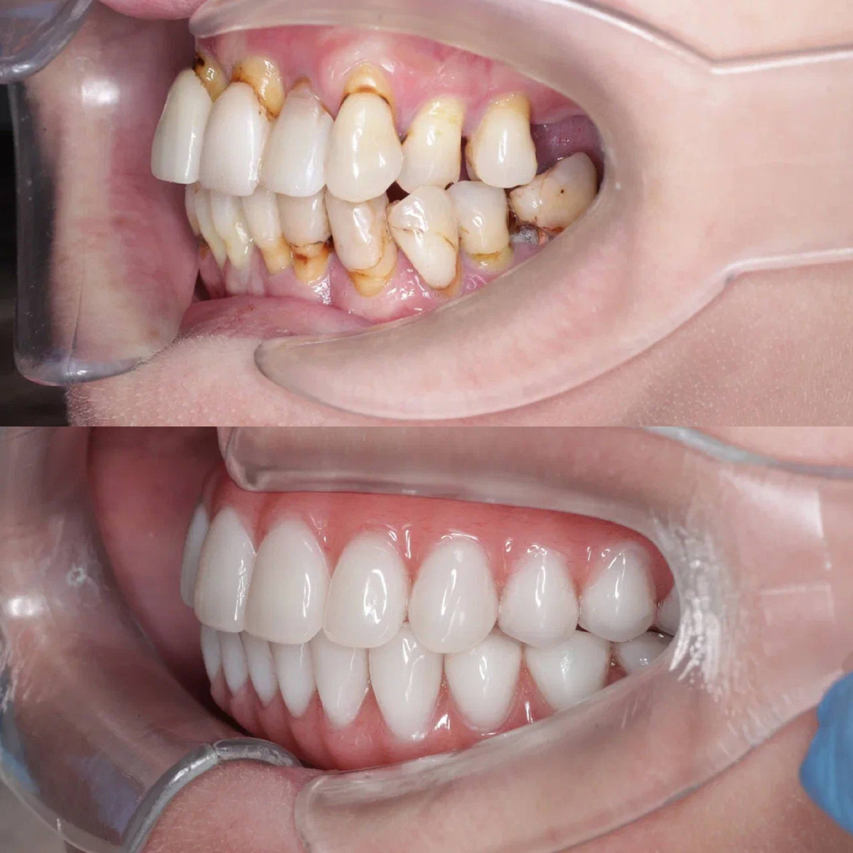 Ольга Ивановна, клиника доктора Севака Estetus г.Москва