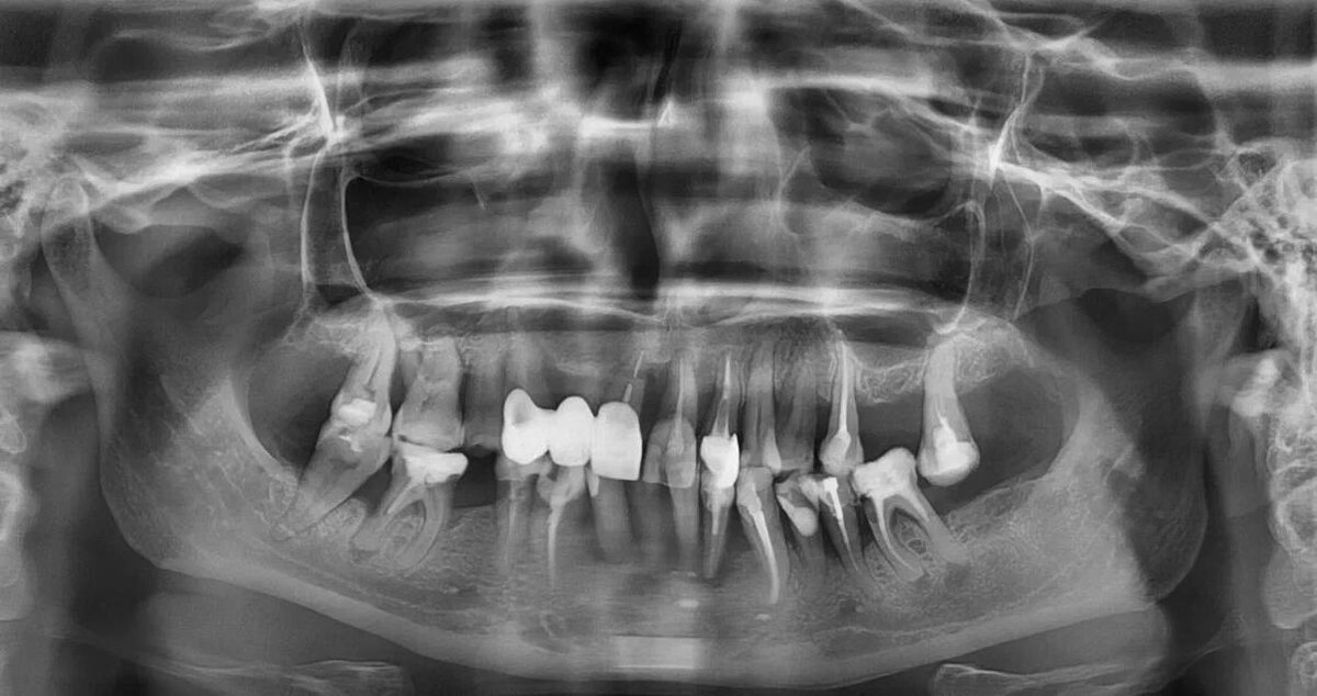 Ольга Ивановна, клиника доктора Севака Estetus г.Москва
